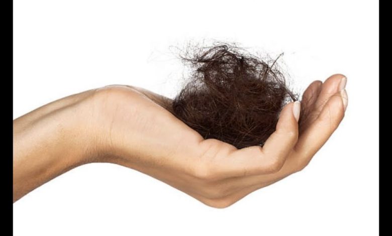 أسباب طبيّة لتساقط الشعر