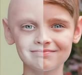 السرطان عند الأطفال